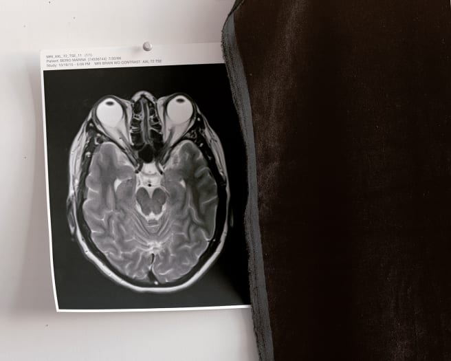 4 Marina Berio MRI with eyeballs and blackness